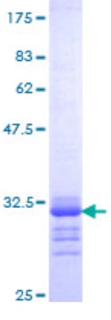 SDS PAGE (BGLAP-205H).jpg